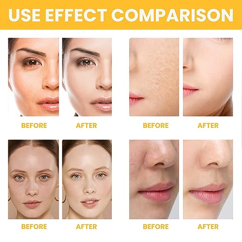 La Crema del Agua del Arroz, Se Descolora las Líneas Finas Adultos de La Crema de Cara de La Reparación del Arroz 1.8oz para el Salón de Belleza