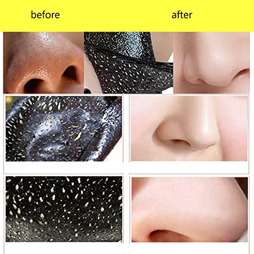 Blackhead Remover Mask,Mascarilla Exfoliante Facial,Puntos Negros Mascarilla,Mascarilla de Carbón,Deep Cleansing Mask,Contra Puntos Negros y Acné