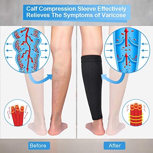 Medias Compresivas, Calcetines De Compresión Para Hombres Y Mujeres, Protector De Pantorrilla Mangas De Compresión Para Piernas Para Soporte De Piernas Correr Viajar Deportistas Hombres Y Mujeres