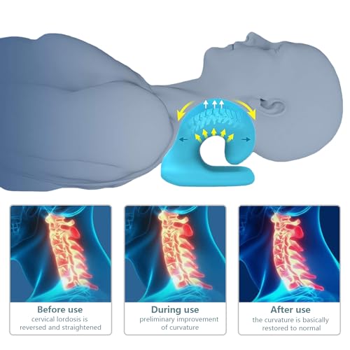 Poligino Almohada de Tracción Quiropráctica,Almohada para Dolor Cervical,Estirar el Cuello y la Columna Vertebral,Almohada Cervicales y Cuello para Aliviar,Dispositivo de Tracción Cervical